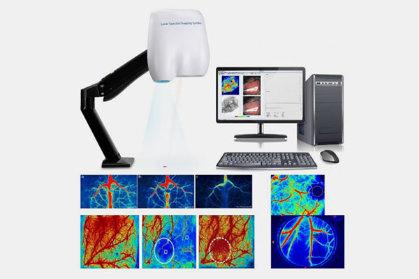 Laser Speckle Contrast Imaging in india