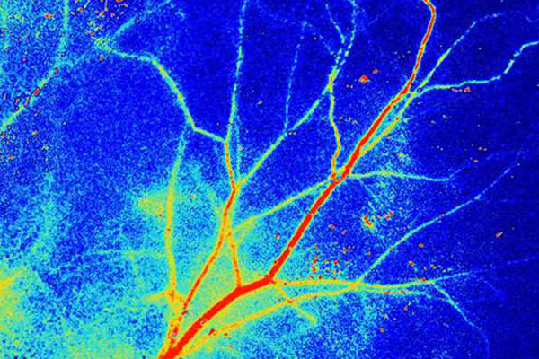 Laser Speckle Contrast Imagingin india